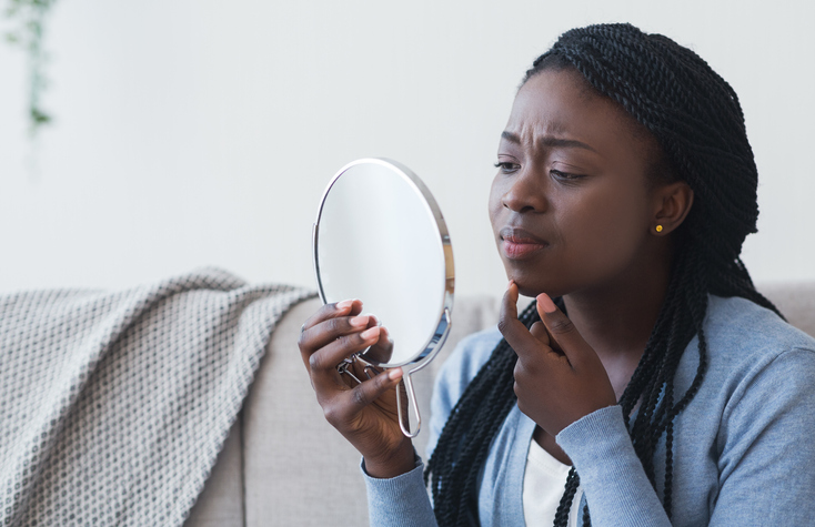 Acne: Considerations for darker skin – Harvard Health Blog